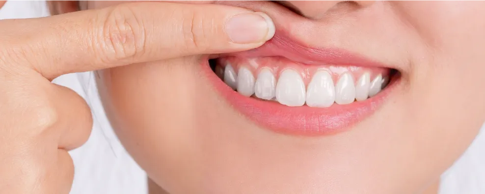 歯や歯茎が原因のタイプ