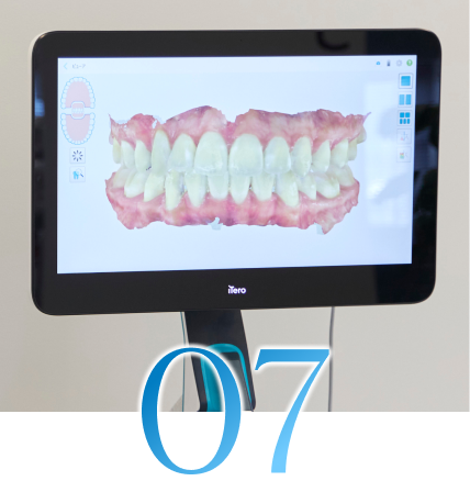 インビザラインのメリット7
