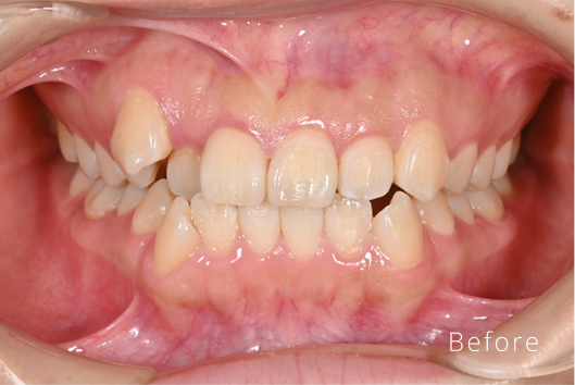 症例画像Before