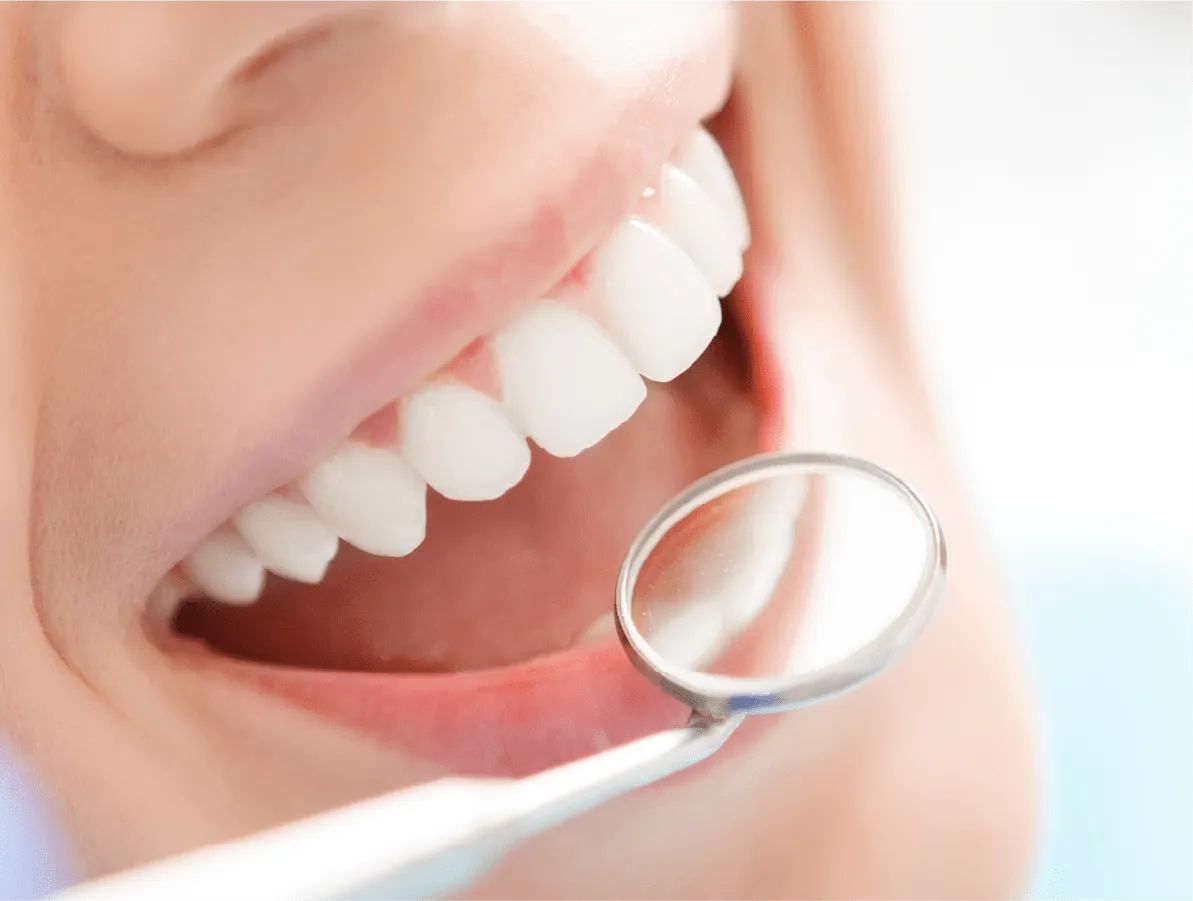 歯周病治療のゴール